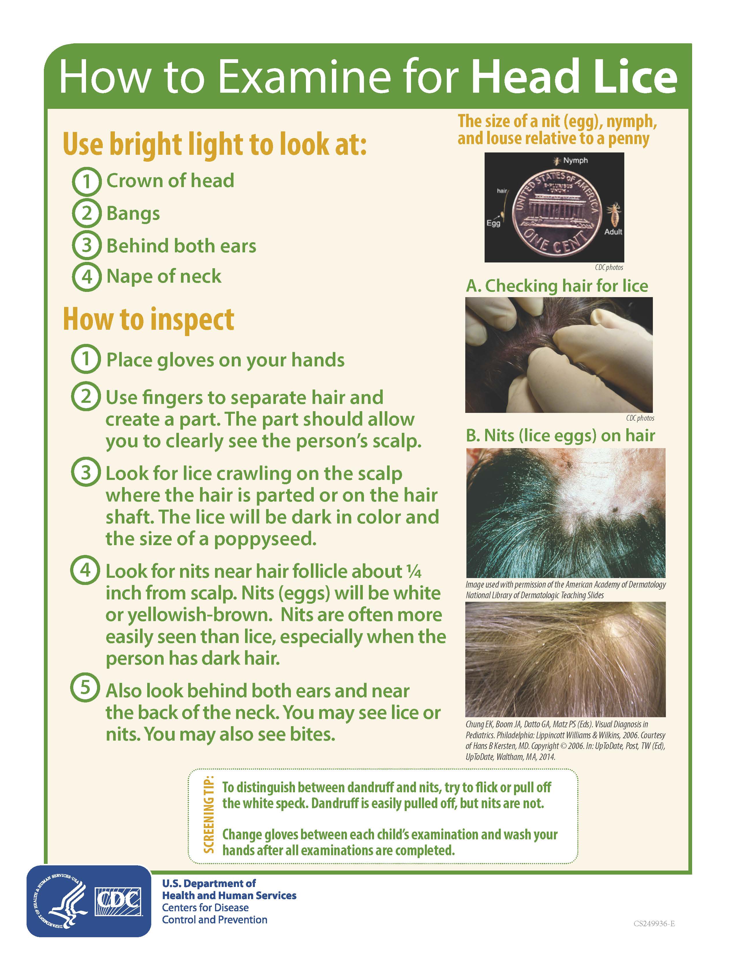 Head Lice Flyer